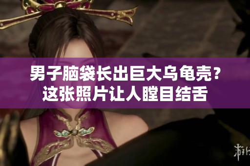 男子脑袋长出巨大乌龟壳?这张照片让人瞠目结舌 男子脑袋长出巨大乌龟壳?这张照片让人瞠目结舌